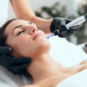 Esthetician performing microneedling on a client's chin